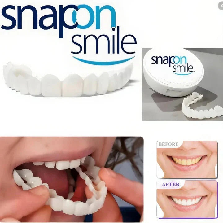Snap on Smile 2Pcs/Set Comfort Fit White Teeth Cover Veneer Kit